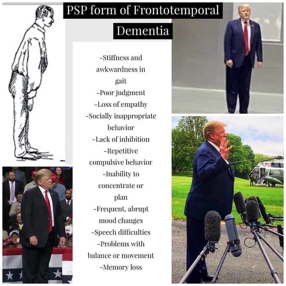 Dementia Don.jpg